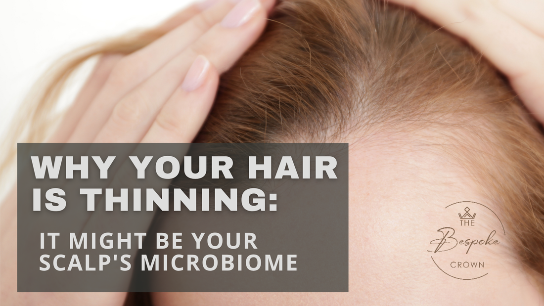 how scalp microbiome affects hair thinning and growth